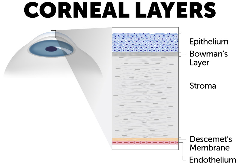 Cornea layer diagram showing corneal layers at risk for corneal injuries and corneal abrasions. 