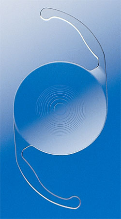 Multifocal intraocular lens (IOL) used to replace a lens with a cataract during cataract eye surgery at Wolfe Eye Clinic.
