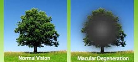 Sight with macular degeneration.